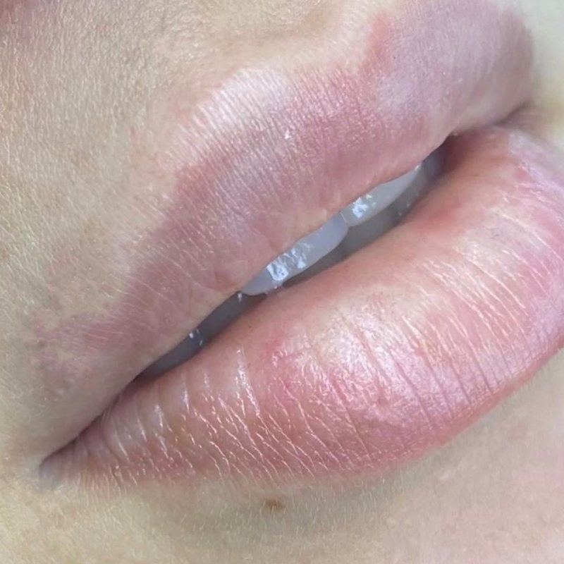 Lips before permanent lip color by Joice